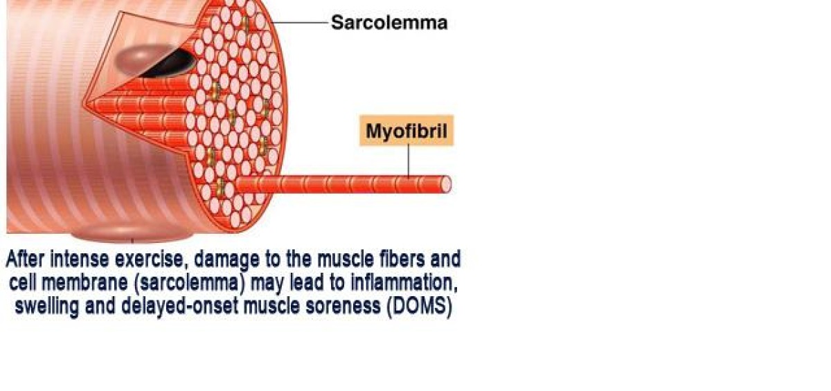 Why Is Muscle Soreness Delayed